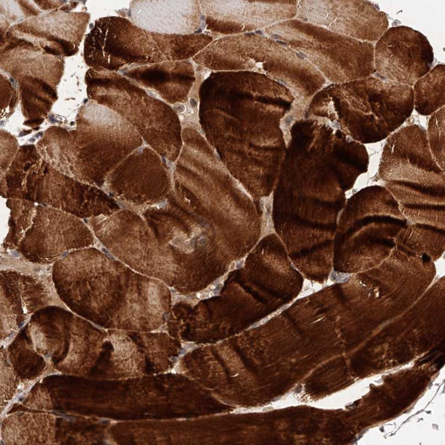 Cullin 7 Antibody in Immunohistochemistry (Paraffin) (IHC (P))