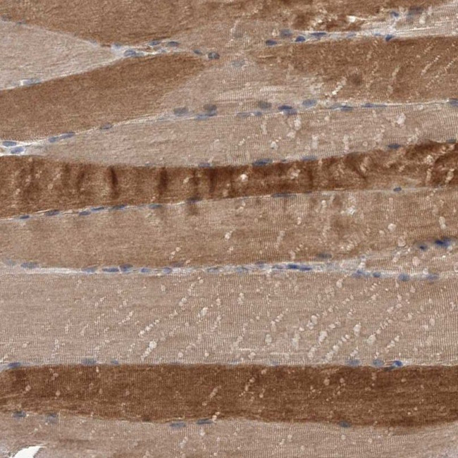 Cullin 7 Antibody in Immunohistochemistry (IHC)