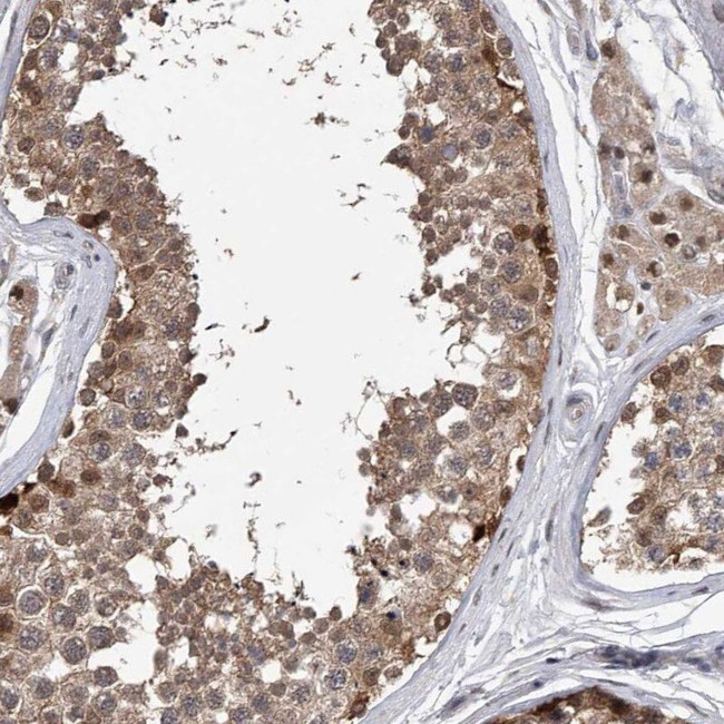 RWDD2A Antibody in Immunohistochemistry (IHC)