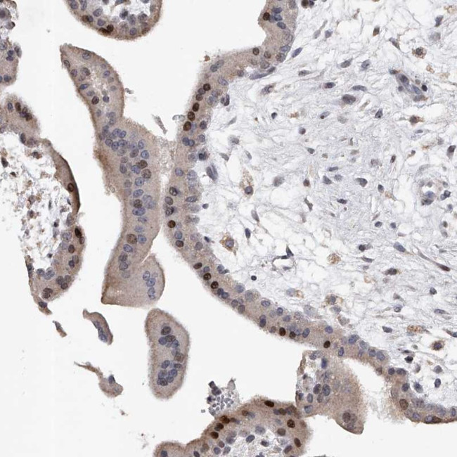 RWDD2A Antibody in Immunohistochemistry (Paraffin) (IHC (P))