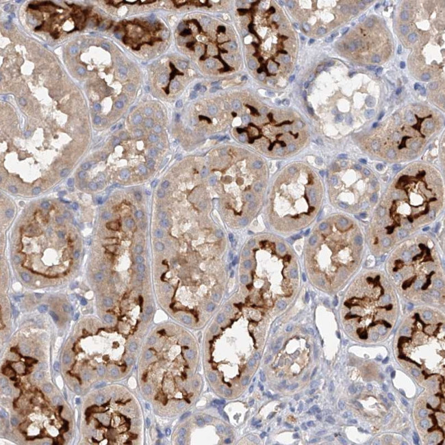 RWDD2A Antibody in Immunohistochemistry (Paraffin) (IHC (P))
