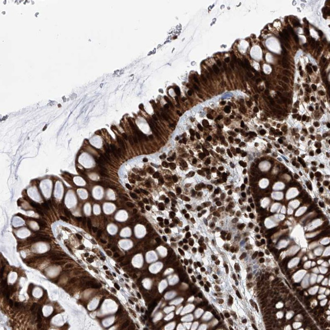 PAK1IP1 Antibody in Immunohistochemistry (Paraffin) (IHC (P))