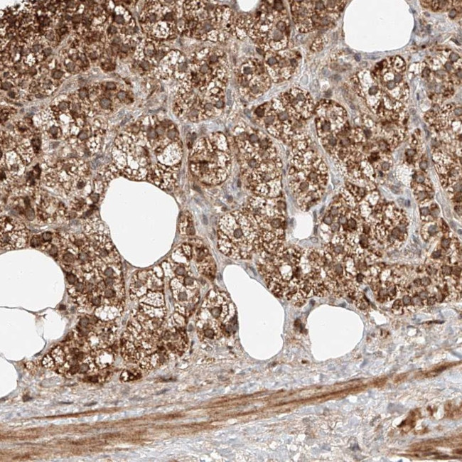 SNX26 Antibody in Immunohistochemistry (Paraffin) (IHC (P))