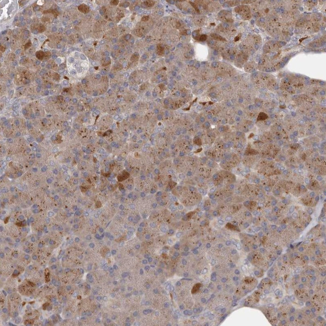 ANR44 Antibody in Immunohistochemistry (Paraffin) (IHC (P))