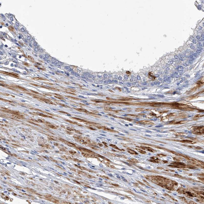 FAM188B Antibody in Immunohistochemistry (Paraffin) (IHC (P))