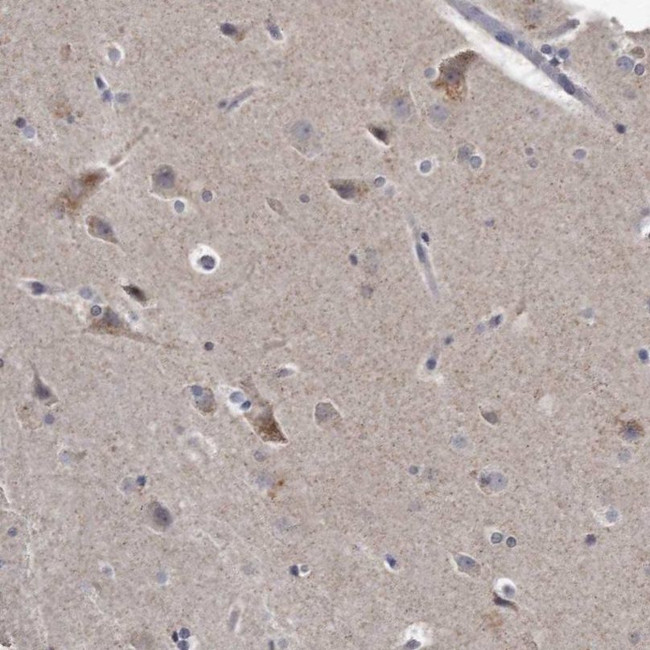 KLDC3 Antibody in Immunohistochemistry (IHC)