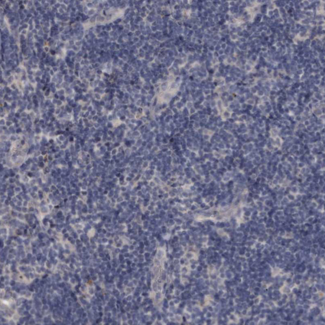 KLDC3 Antibody in Immunohistochemistry (Paraffin) (IHC (P))