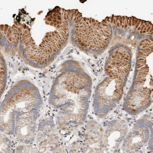 IQGAP3 Antibody in Immunohistochemistry (Paraffin) (IHC (P))