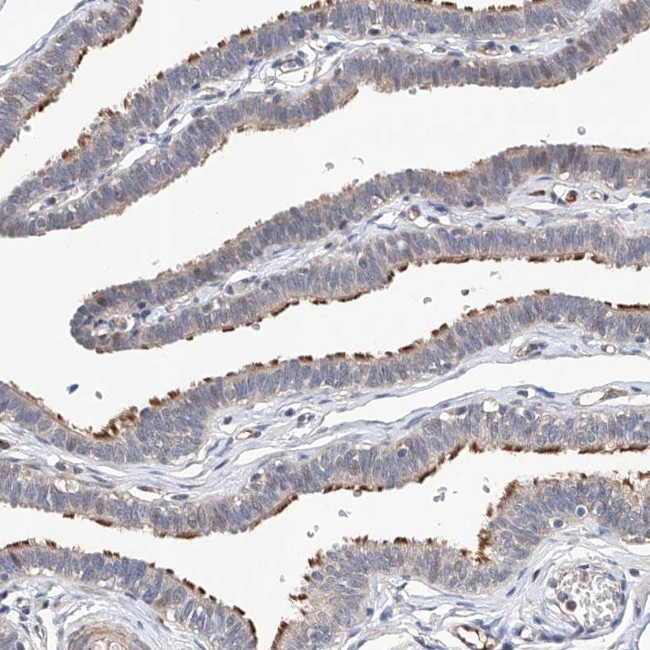 LACE1 Antibody in Immunohistochemistry (Paraffin) (IHC (P))