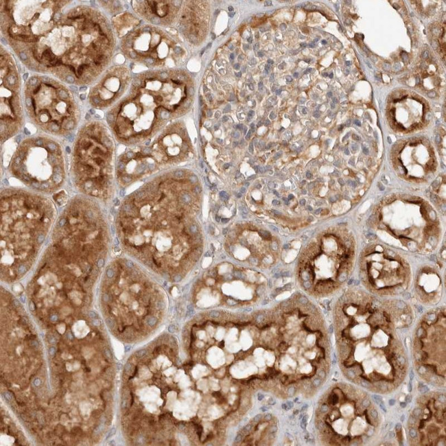 PKIB Antibody in Immunohistochemistry (Paraffin) (IHC (P))