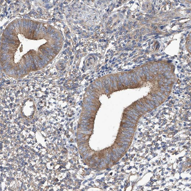 TJAP1 Antibody in Immunohistochemistry (Paraffin) (IHC (P))