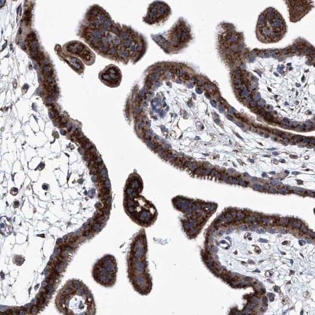 TJAP1 Antibody in Immunohistochemistry (IHC)