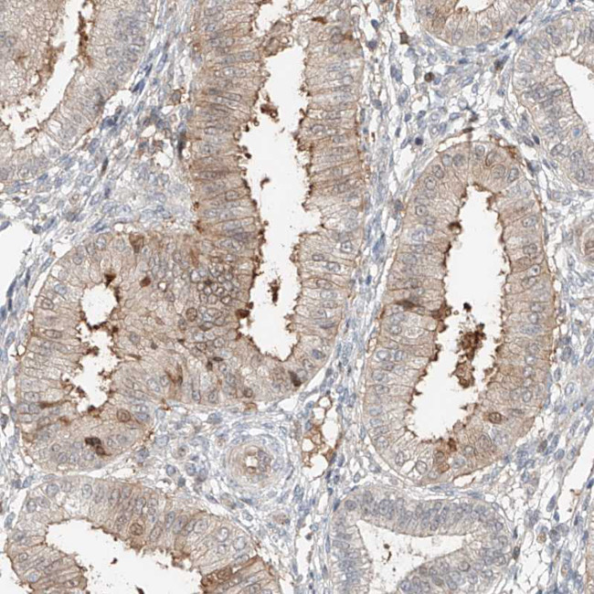 CEP162 Antibody in Immunohistochemistry (IHC)