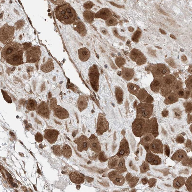 CEP162 Antibody in Immunohistochemistry (Paraffin) (IHC (P))