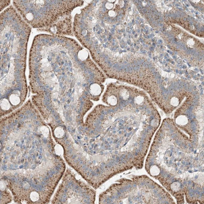 CEP162 Antibody in Immunohistochemistry (Paraffin) (IHC (P))
