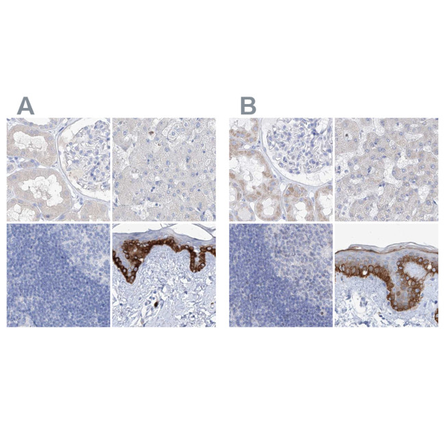 FRS3 Antibody in Immunohistochemistry (IHC)