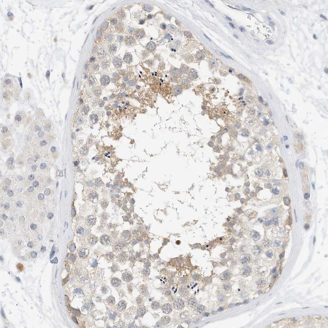 MICAL1 Antibody in Immunohistochemistry (Paraffin) (IHC (P))