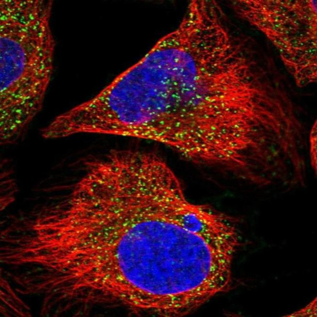 AGPS Antibody in Immunocytochemistry (ICC/IF)