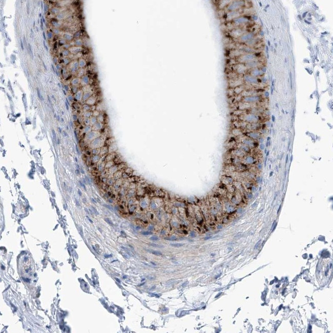 AGPS Antibody in Immunohistochemistry (Paraffin) (IHC (P))