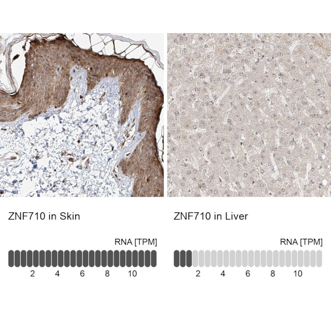 ZNF710 Antibody in Immunohistochemistry (IHC)