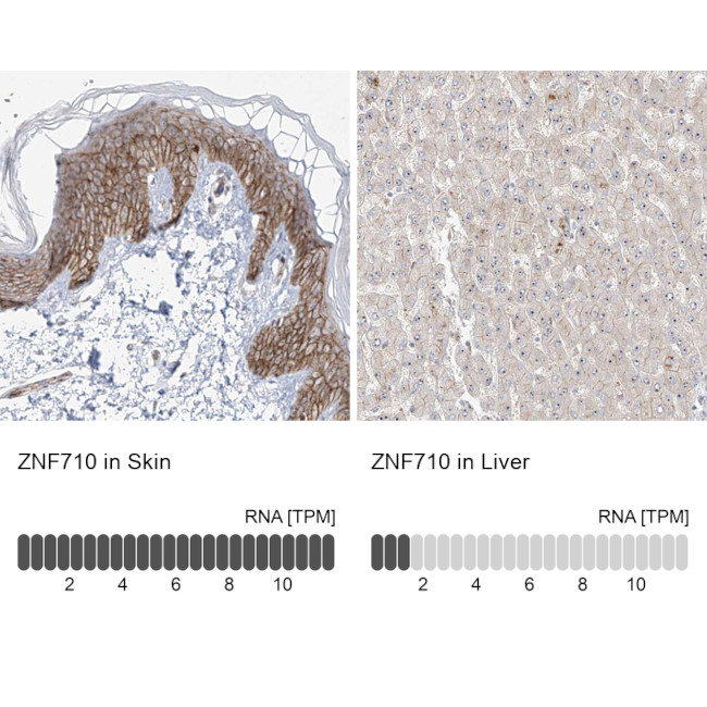 ZNF710 Antibody in Immunohistochemistry (IHC)