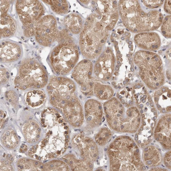 MTO1 Antibody in Immunohistochemistry (Paraffin) (IHC (P))