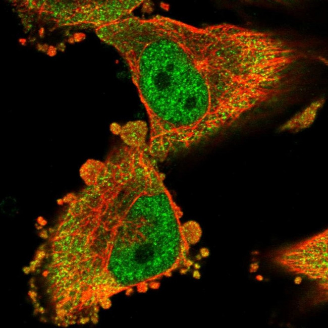 MTO1 Antibody in Immunocytochemistry (ICC/IF)