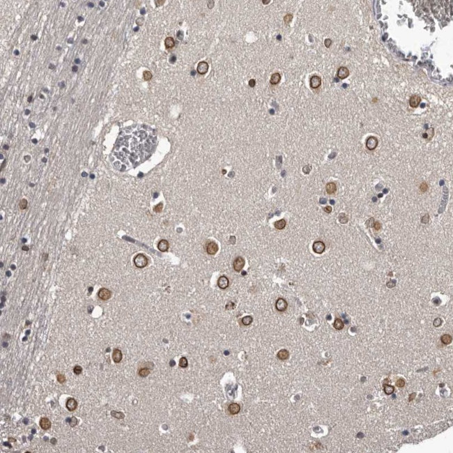 C1orf50 Antibody in Immunohistochemistry (Paraffin) (IHC (P))