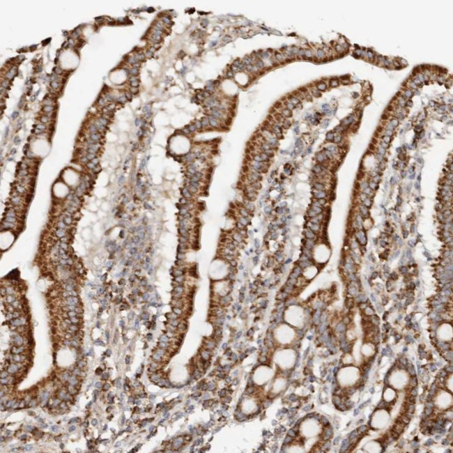 PCBP3 Antibody in Immunohistochemistry (Paraffin) (IHC (P))
