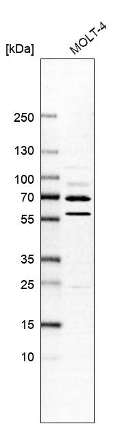 USP49 Antibody in Western Blot (WB)