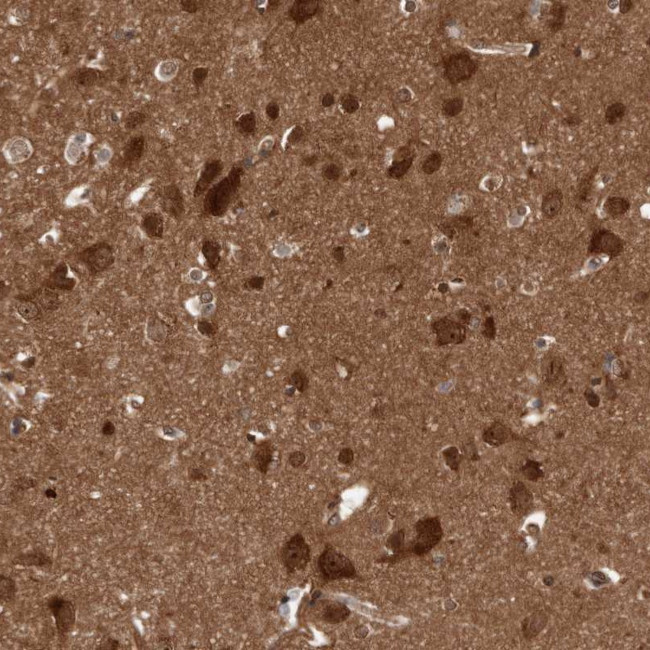 DIP2C Antibody in Immunohistochemistry (Paraffin) (IHC (P))