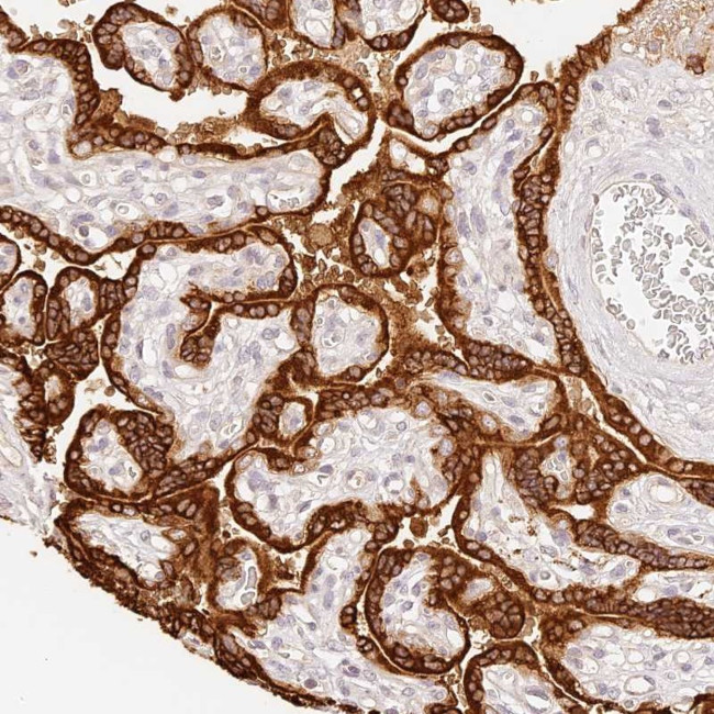 TRIM45 Antibody in Immunohistochemistry (Paraffin) (IHC (P))