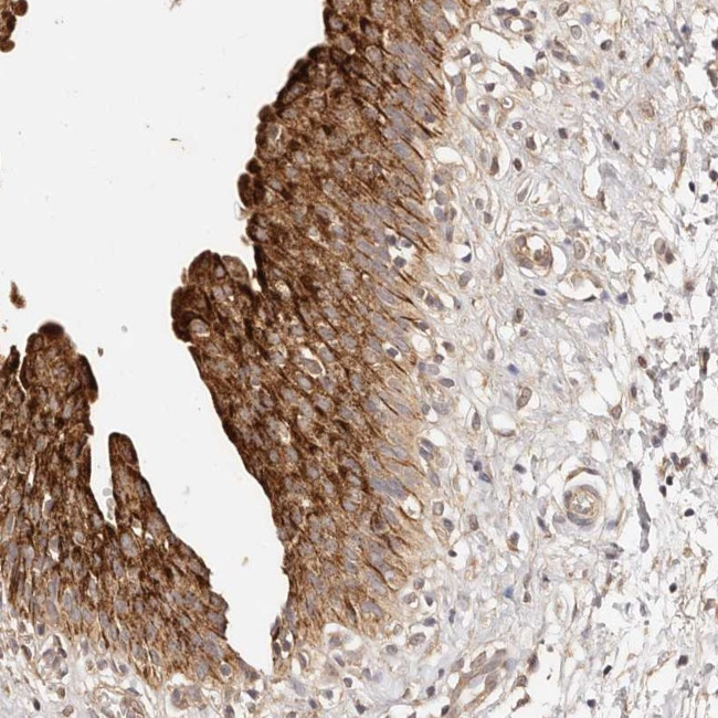 CCL14 Antibody in Immunohistochemistry (Paraffin) (IHC (P))