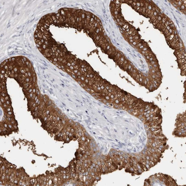 AKNAD1 Antibody in Immunohistochemistry (Paraffin) (IHC (P))