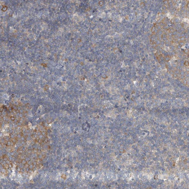 AKNAD1 Antibody in Immunohistochemistry (Paraffin) (IHC (P))