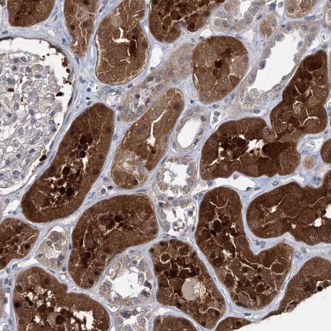 AKNAD1 Antibody in Immunohistochemistry (Paraffin) (IHC (P))