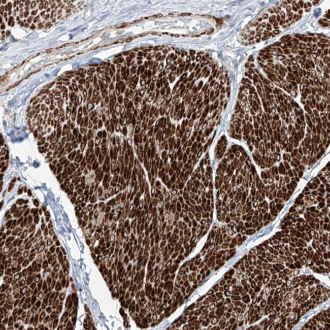 UFD1L Antibody in Immunohistochemistry (Paraffin) (IHC (P))