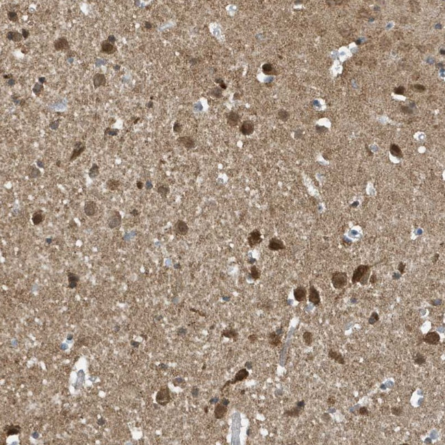 NCOA7 Antibody in Immunohistochemistry (Paraffin) (IHC (P))