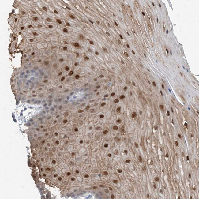 NCOA7 Antibody in Immunohistochemistry (Paraffin) (IHC (P))
