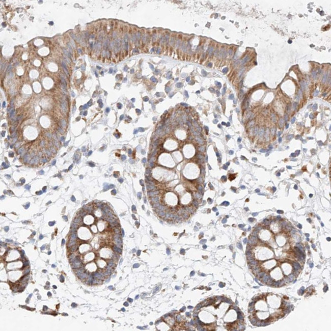 MRPL24 Antibody in Immunohistochemistry (Paraffin) (IHC (P))