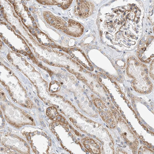 TYSND1 Antibody in Immunohistochemistry (Paraffin) (IHC (P))