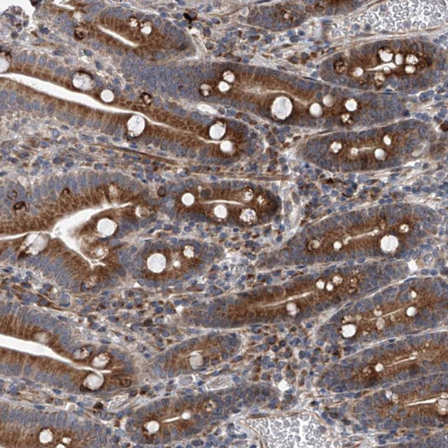SAPAP2 Antibody in Immunohistochemistry (Paraffin) (IHC (P))