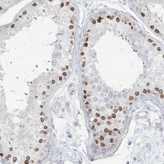 PRDM6 Antibody in Immunohistochemistry (Paraffin) (IHC (P))