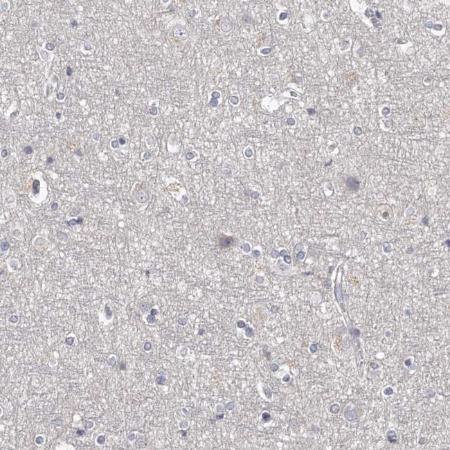 NT5D1 Antibody in Immunohistochemistry (Paraffin) (IHC (P))
