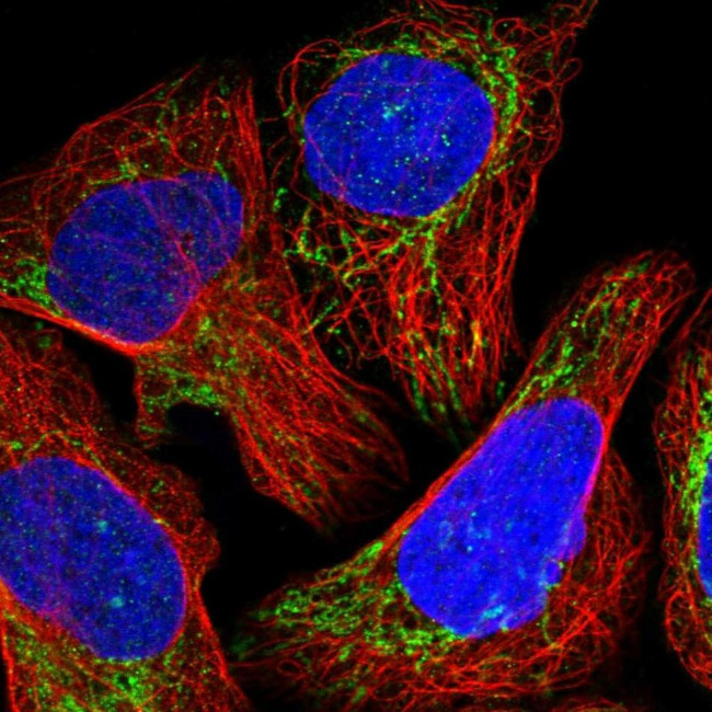 NDUFB11 Antibody in Immunocytochemistry (ICC/IF)