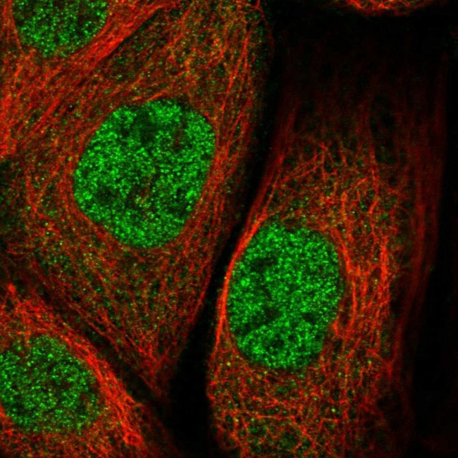ZNF30 Antibody in Immunocytochemistry (ICC/IF)