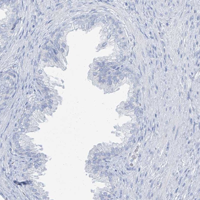 TXLNB Antibody in Immunohistochemistry (Paraffin) (IHC (P))