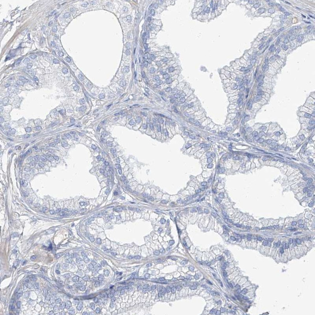TXLNB Antibody in Immunohistochemistry (Paraffin) (IHC (P))