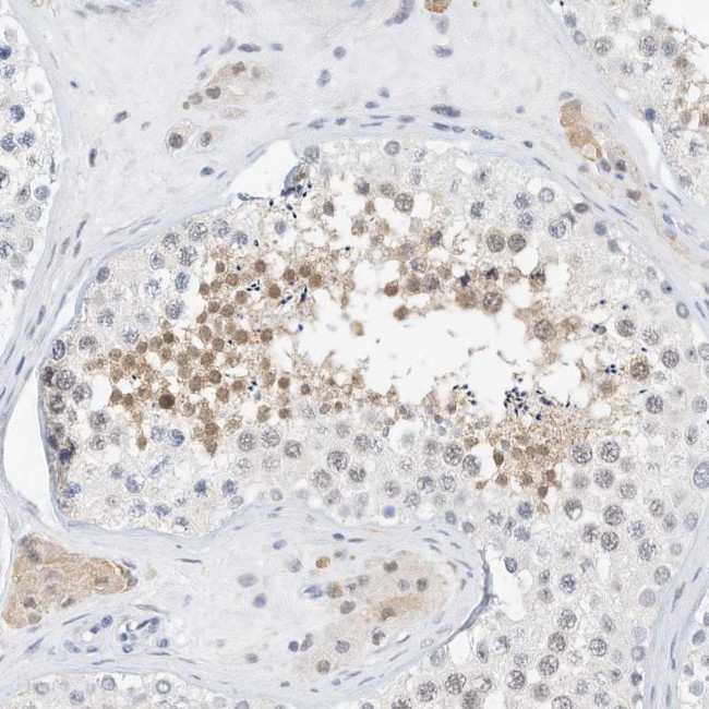 ARHGAP28 Antibody in Immunohistochemistry (Paraffin) (IHC (P))