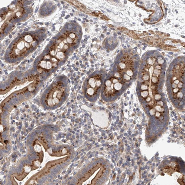 SLC37A1 Antibody in Immunohistochemistry (Paraffin) (IHC (P))